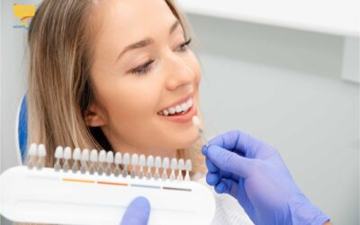 Faccette dentali per rinnovare l’estetica del sorriso