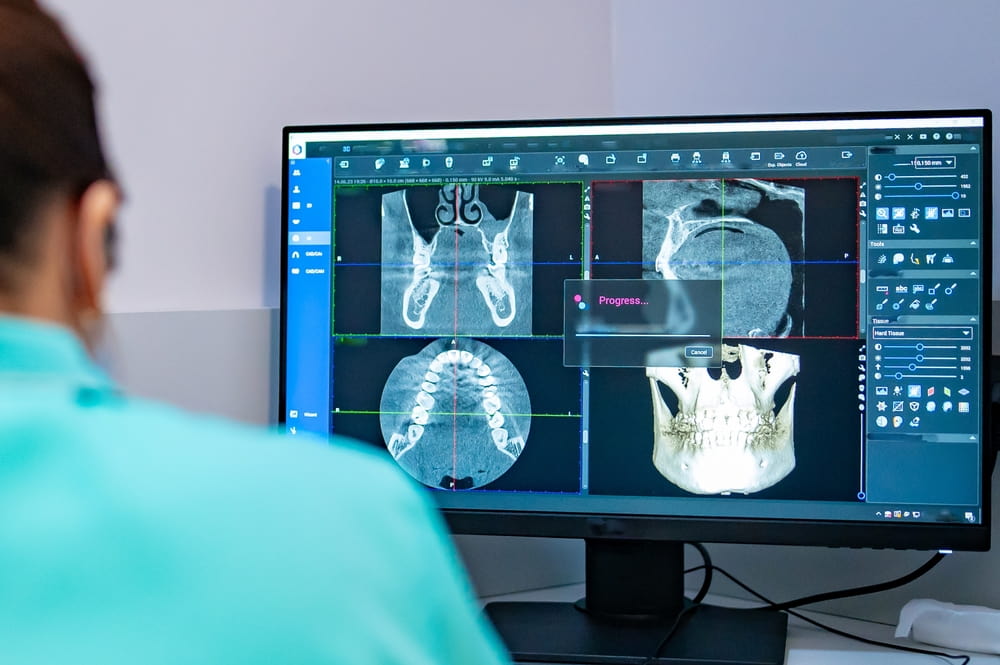 dentista, di spalle, progetta al computer terapia dentale su software di progettazione implantare