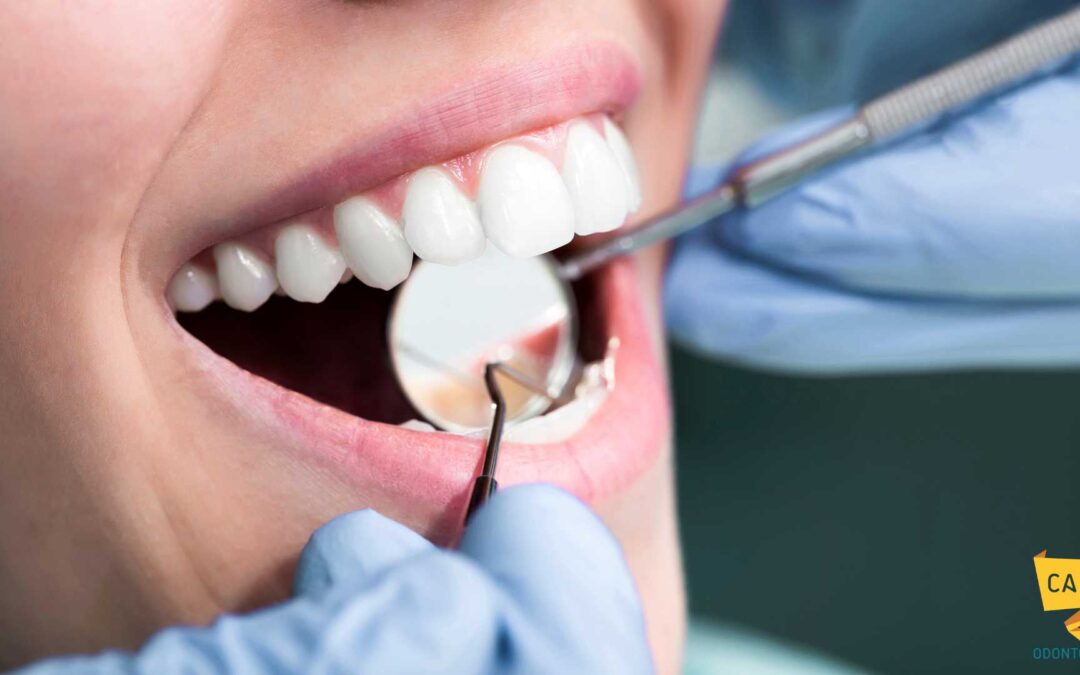Riabilitazione completa della bocca: in cosa consiste