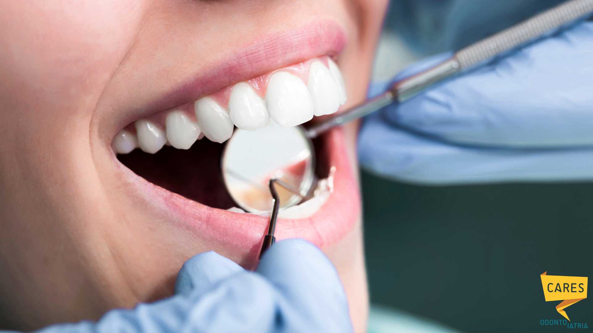 Visita odontoiatrica con strumenti dentistici durante un controllo dei denti