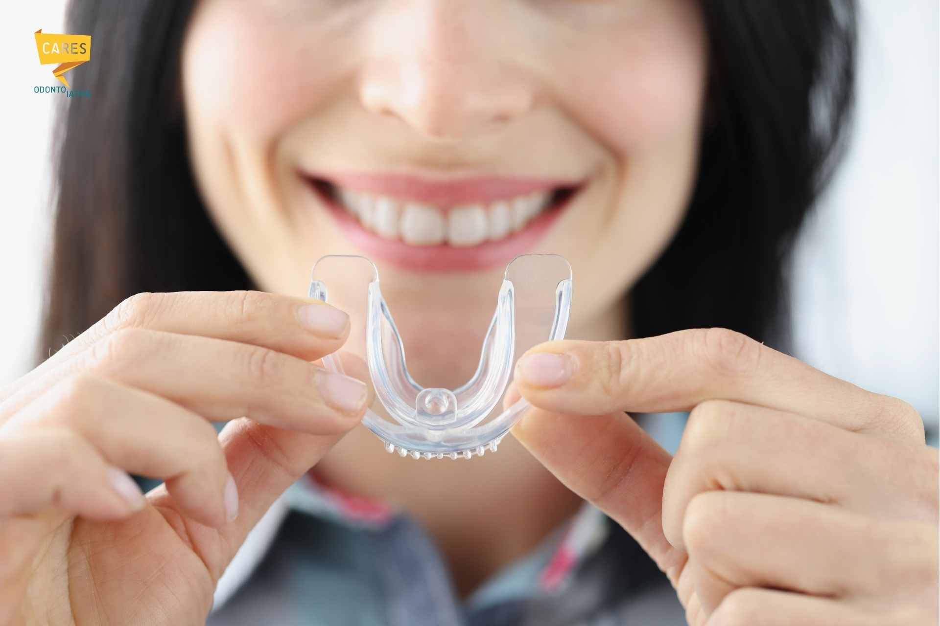 Donna sorridente mostra un bite trasparente per digrignare i denti e proteggere i denti dal bruxismo notturno.