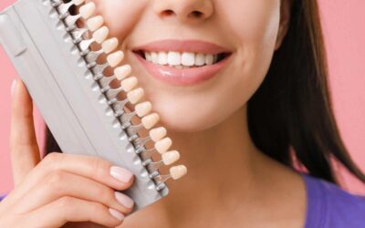 Le faccette dentali rovinano i denti? Ecco la risposta