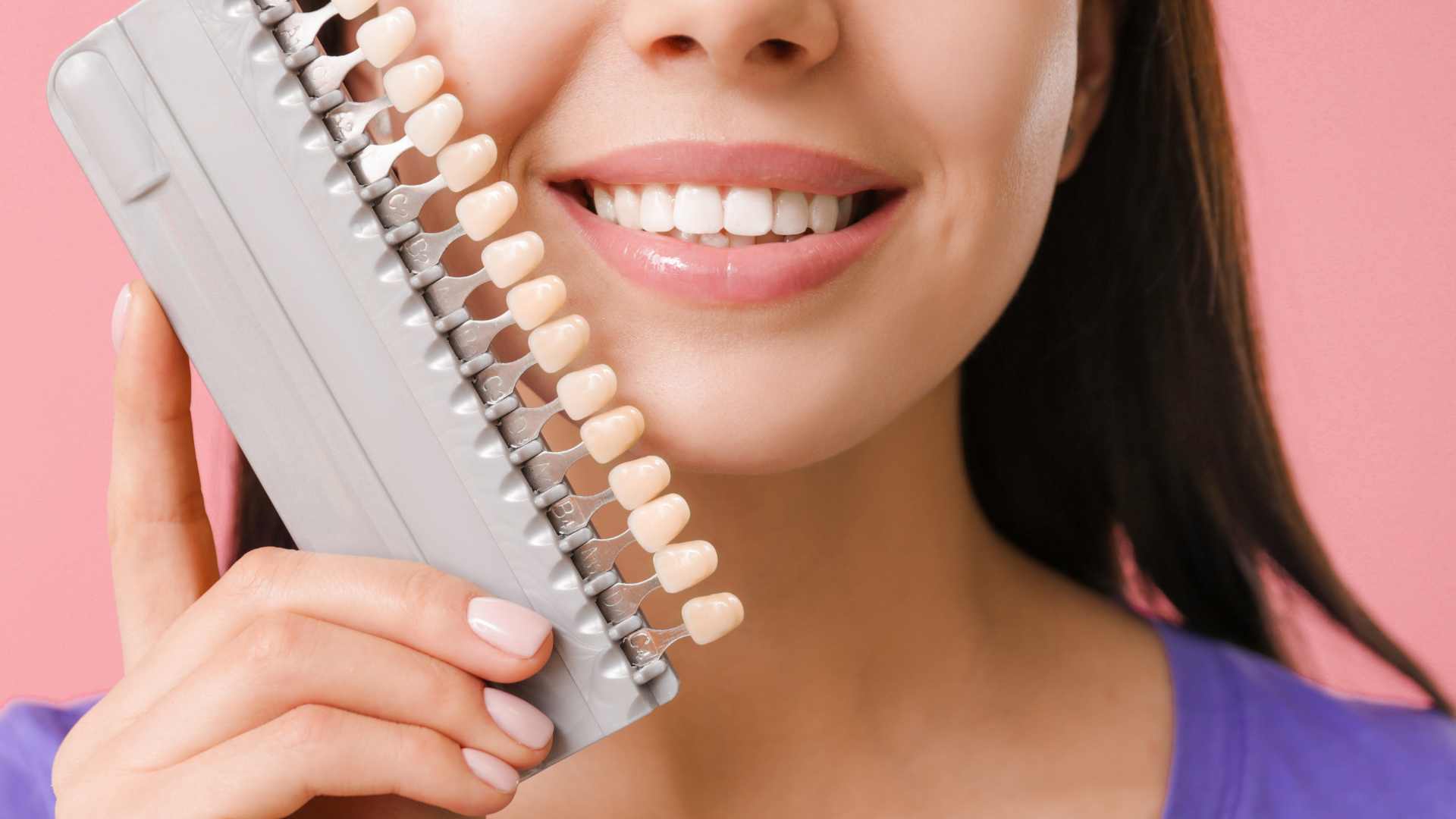 Le faccette dentali rovinano i denti? Prova colore in studio dentistico a Cagliari.