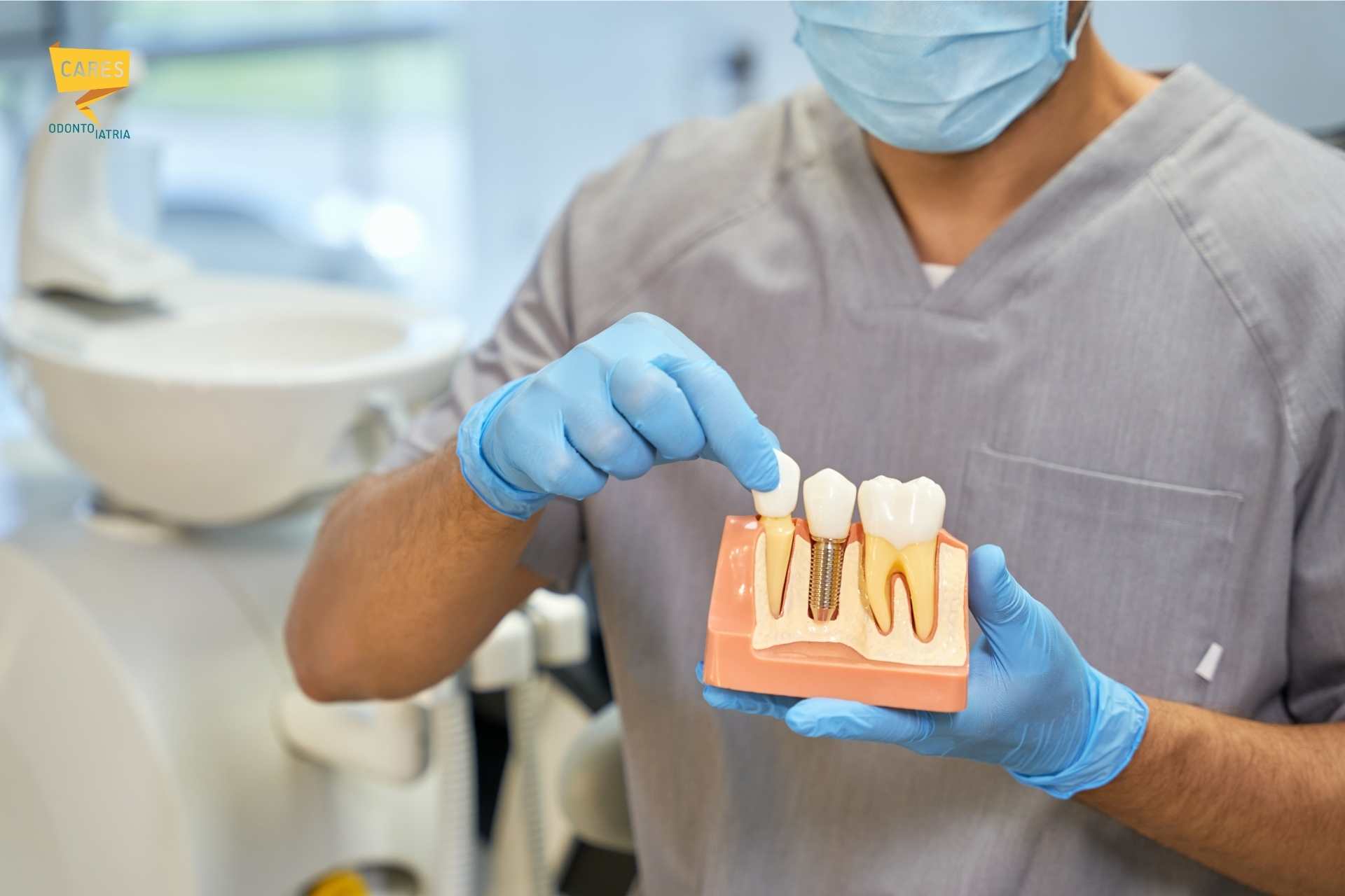 Dimostrazione di impianto dentale con modello 3D presso Cares Odontoiatria Uta, vicino a Decimomannu.