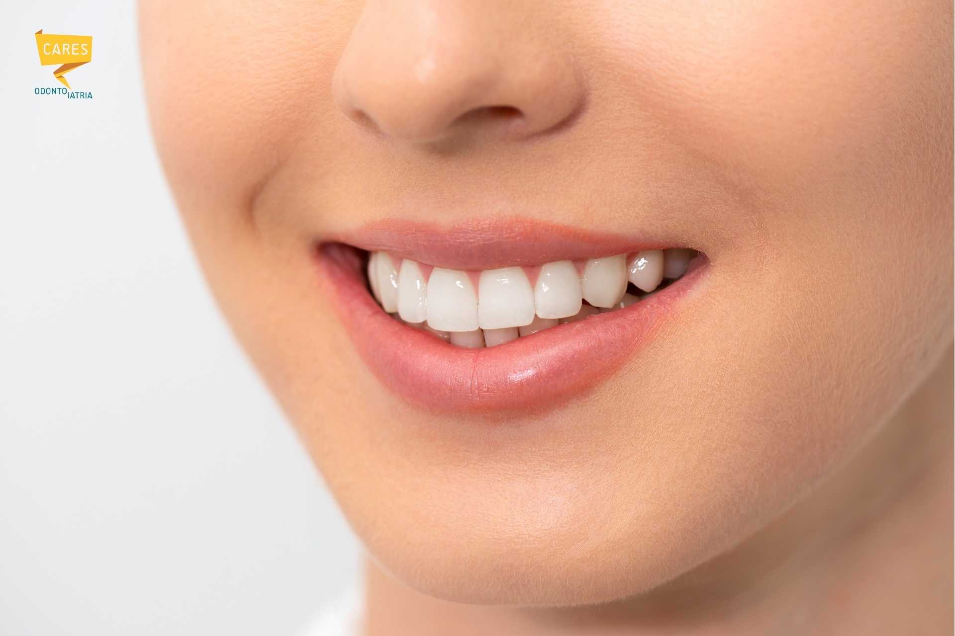 Sorriso naturale e luminoso dopo trattamento di igiene dentale e sbiancamento professionale presso dentista Siliqua Cares Odontoiatria