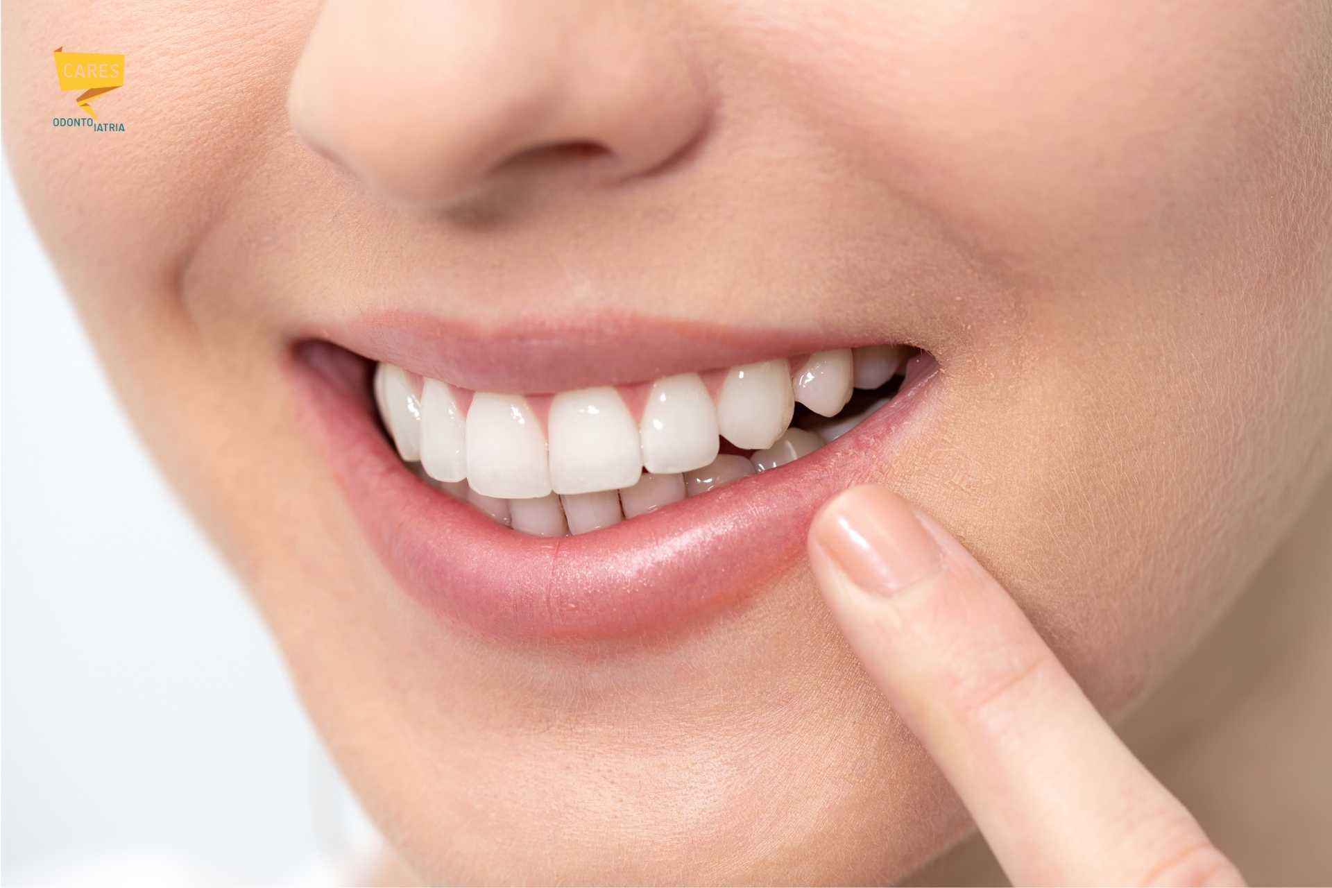 Dettaglio di un sorriso sano dopo un trattamento di chirurgia orale eseguito presso Cares Odontoiatria Uta, vicino a Villasor