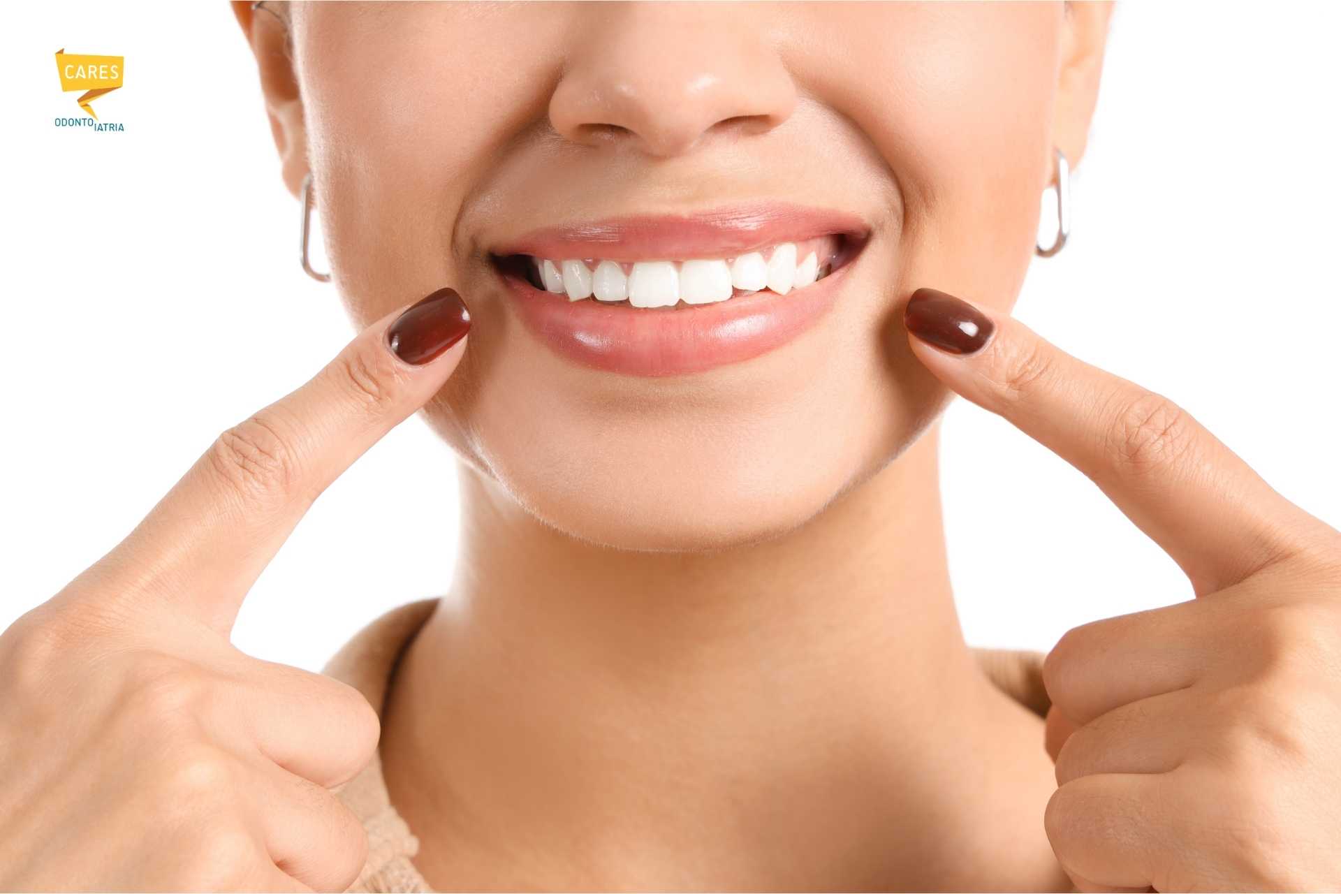 Donna che mostra un sorriso con denti sani dopo la ricostruzione di un dente scheggiato presso CARES Odontoiatria.