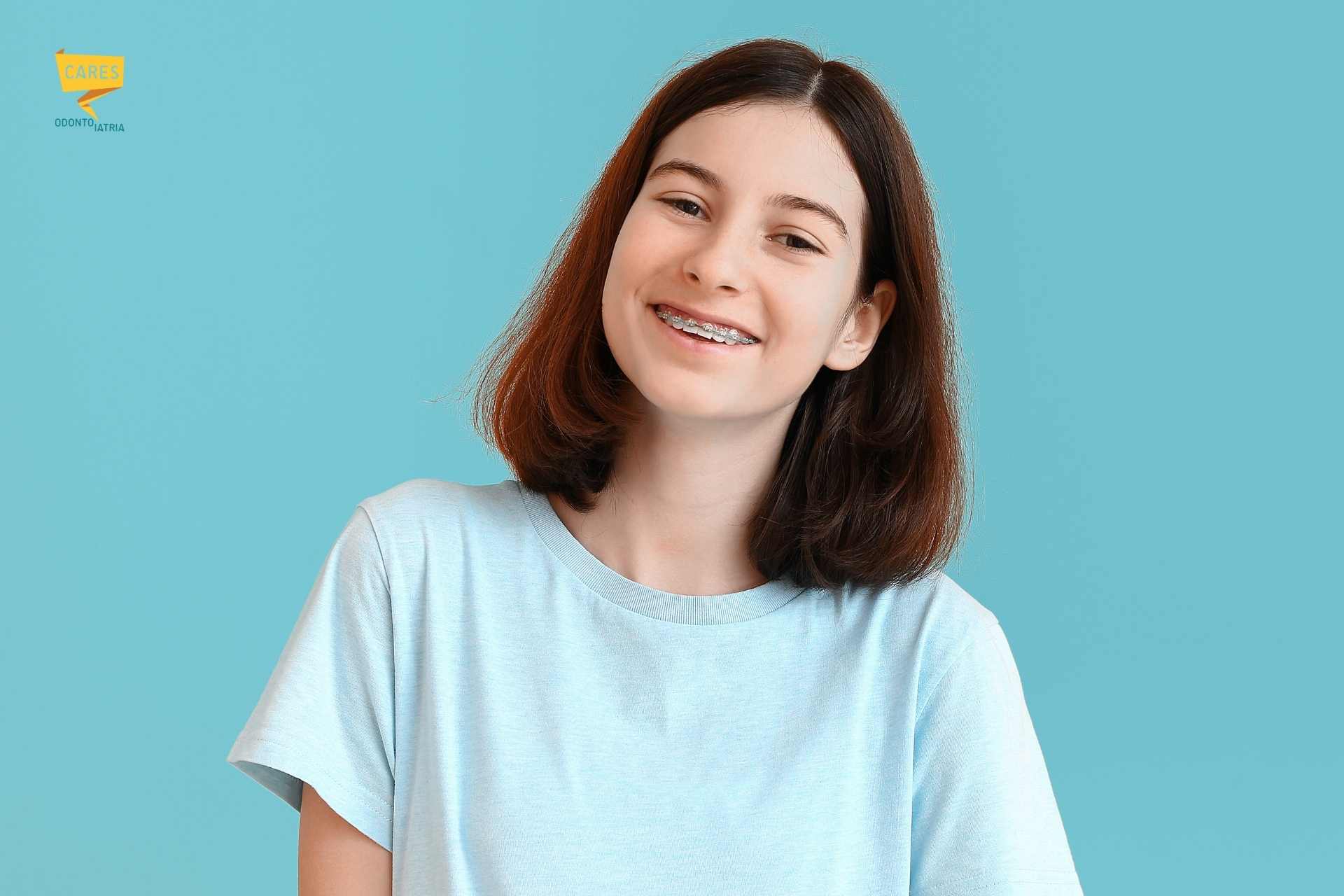 Apparecchi dentali: esempio di apparecchio fisso Ragazza che sorride indossando apparecchi dentali fissi su sfondo azzurro