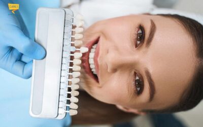 Denti con faccette: quali sono gli svantaggi da conoscere?