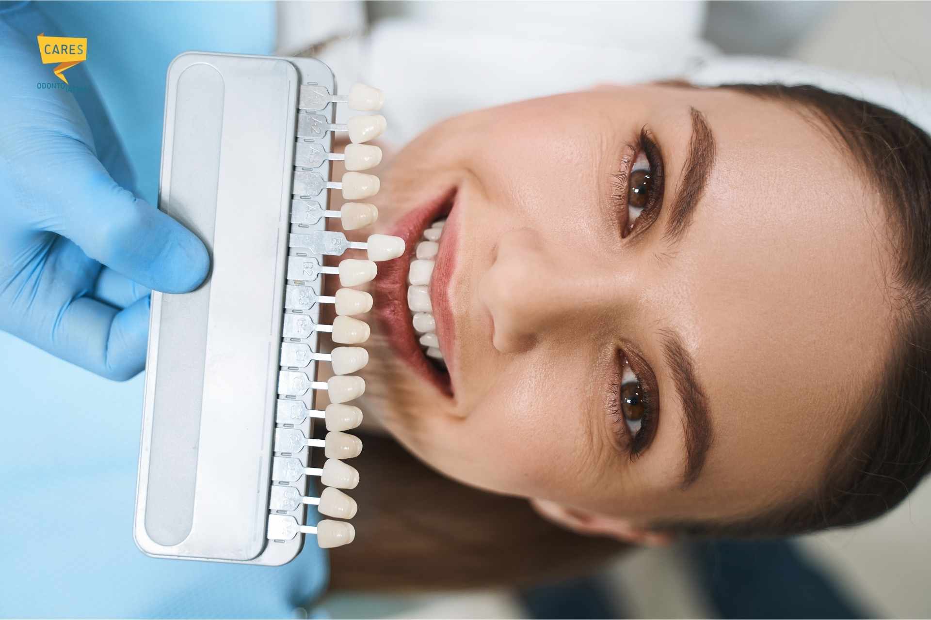 Paziente durante la scelta del colore delle faccette dentali per migliorare l’estetica del sorriso