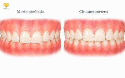 Morso profondo: diagnosi e cura bambini e adulti