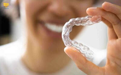 Allineatore dentale: cos’è e quando usarlo