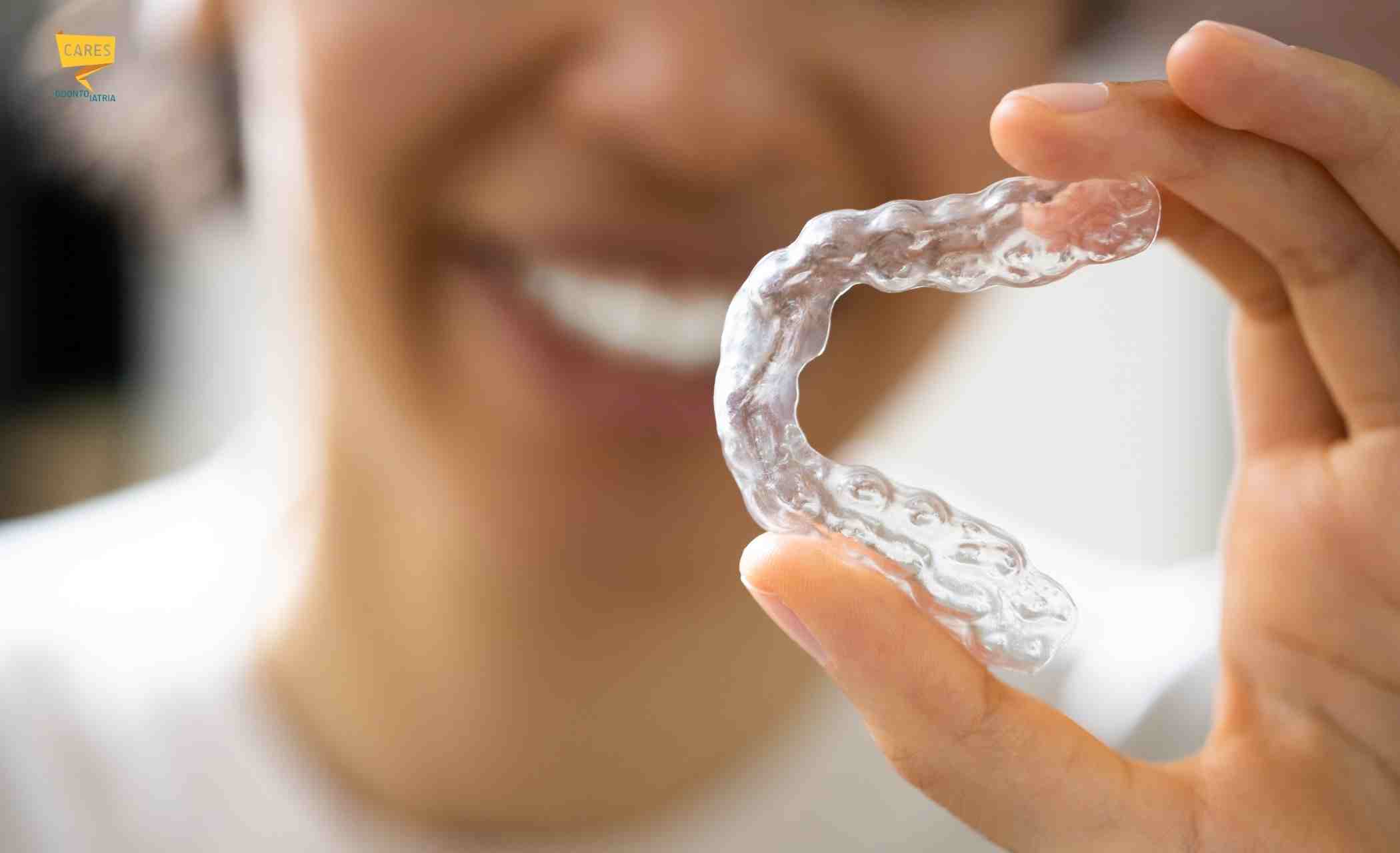 Allineatore dentale trasparente tenuto in mano da una paziente durante un trattamento di ortodonzia invisibile per denti storti.