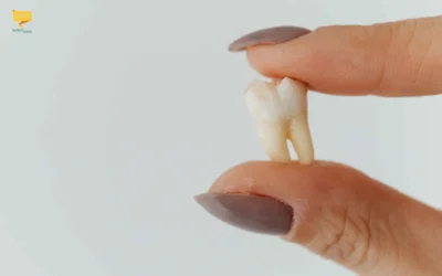Fa male togliere il dente del giudizio? Ecco la risposta