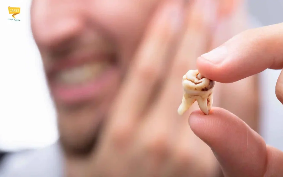 Dente cariato: cosa succede se non si cura?
